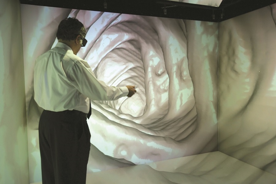 Virtual Colonoscopy