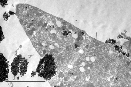 Biological Cell uptake nanoparticles